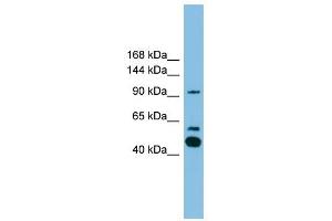PLA2G4E antibody used at 1 ug/ml to detect target protein. (PLA2G4E antibody  (C-Term))