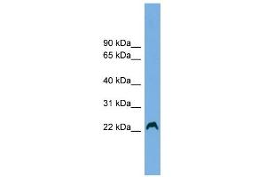 WB Suggested Anti-HAX1 Antibody Titration: 0. (HAX1 antibody  (Middle Region))