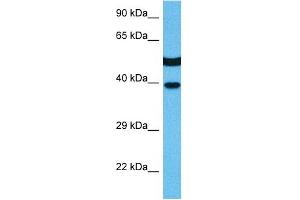 Host:  Mouse  Target Name:  MAPK14  Sample Tissue:  Mouse Kidney  Antibody Dilution:  1ug/ml (MAPK14 antibody  (C-Term))