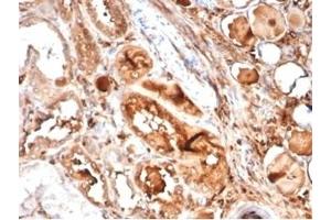 Formalin-fixed, paraffin-embedded human kidney stained with MICA Mouse Recombinant Monoclonal Antibody (MICA/4442). (MICA antibody  (AA 1-200))