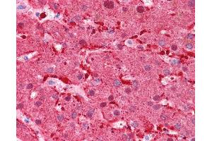 Immunohistochemistry (IHC) image for anti-Fatty Acid Binding Protein 1, Liver (FABP1) (N-Term) antibody (ABIN2782982) (FABP1 antibody  (N-Term))