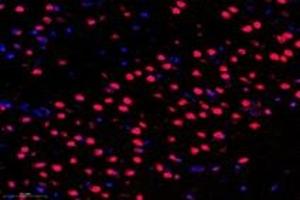Immunofluorescent analysis of paraformaldehyde-fixed rat frontal lobe using PARIS (ABIN7076272) at dilution of 1: 3000 (ZNF746 antibody)