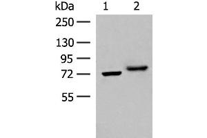 Western blot analysis of A172 and HepG2 cell lysates using POMGNT1 Polyclonal Antibody at dilution of 1:400 (POMGNT1 antibody)
