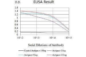 Black line: Control Antigen (100 ng),Purple line: Antigen (10 ng), Blue line: Antigen (50 ng), Red line:Antigen (100 ng) (IL4 Receptor antibody  (AA 26-232))