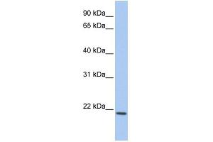 WB Suggested Anti-IL22 Antibody Titration:  0. (IL-22 antibody  (C-Term))