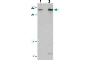 Western blot analysis of TLX2 in rat brain tissue with TLX2 polyclonal antibody  at (lane 1) 0. (TLX2 antibody  (N-Term))