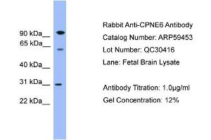 WB Suggested Anti-CPNE6  Antibody Titration: 0. (CPNE6 antibody  (Middle Region))
