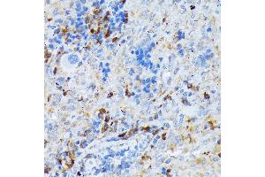 Immunohistochemistry of paraffin-embedded rat spleen using CD209 Rabbit mAb (ABIN7266173) at dilution of 1:100 (40x lens). (DC-SIGN/CD209 antibody)