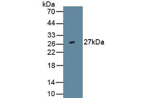 Detection of Recombinant IL29, Human using Monoclonal Antibody to Interleukin 29 (IL29) (IL29 antibody  (AA 20-200))