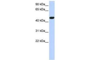Image no. 1 for anti-Calcium Channel, Voltage-Dependent, beta 4 Subunit (CACNB4) (AA 250-300) antibody (ABIN6742717) (CACNB4 antibody  (AA 250-300))