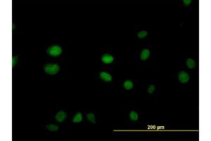 Immunofluorescence of monoclonal antibody to SGK2 on HeLa cell. (SGK2 antibody  (AA 293-367))