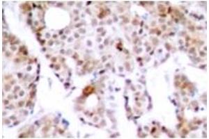 Image no. 2 for anti-Myc Proto-Oncogene protein (MYC) (pThr58) antibody (ABIN318075) (c-MYC antibody  (pThr58))