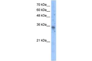 SLC25A16 antibody used at 5 ug/ml to detect target protein. (SLC25A16 antibody  (N-Term))