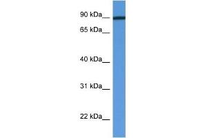 Western Blot showing PFKM antibody used at a concentration of 1 ug/ml against Fetal Heart Lysate (PFKM antibody  (C-Term))