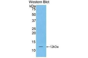 Detection of Recombinant S100A5, Human using Monoclonal Antibody to S100 Calcium Binding Protein A5 (S100A5) (S100A5 antibody  (AA 1-92))