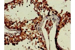 Immunohistochemistry of paraffin-embedded human testis tissue using ABIN7150470 at dilution of 1:100 (CRCP antibody  (AA 1-115))
