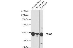 Western blot analysis of extracts of various cell lines, using FBXO2 antibody (ABIN6130381, ABIN6140514, ABIN6140515 and ABIN6224682) at 1:1000 dilution. (FBXO2 antibody  (AA 1-296))