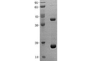 Validation with Western Blot (GGACT Protein (His tag))