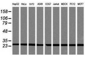 Image no. 2 for anti-Proteasome Subunit alpha 2 (PSMA2) (AA 50-234) antibody (ABIN1491568) (PSMA2 antibody  (AA 50-234))