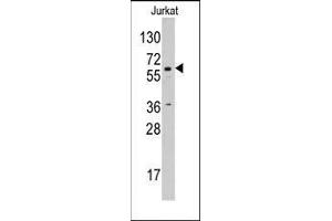 Western blot analysis using AP14221PU-N CYP19A1 antibody in Jurkat cell line lysates (35 µg/lane).