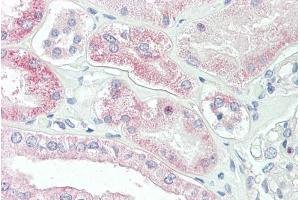 ABIN571063 (3. (SLC4A11 antibody  (Internal Region))