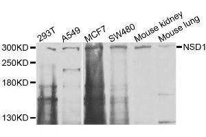 Western blot analysis of extracts of various cell lines, using NSD1 antibody (ABIN6003690) at 1/1000 dilution. (NSD1 antibody)