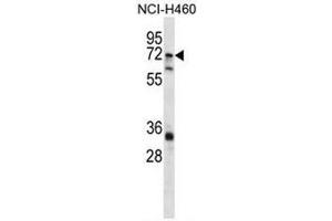 ST6GALNAC1 Antibody (N-term) western blot analysis in NCI-H460 cell line lysates (35µg/lane).
