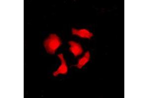 Immunofluorescent analysis of CABLES1 staining in SHSY5Y cells. (CABLES1 antibody  (C-Term))
