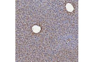 IHC analysis of SBP/SELENBP1 using anti-SBP/SELENBP1 antibody (ABIN7600755). (SELENBP1 antibody  (AA 23-462))