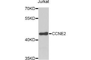 Western blot analysis of extracts of Jurkat cells, using CCNE2 antibody. (Cyclin E2 antibody)