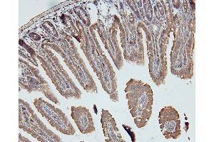 IHC analysis of DDR1 using anti-DDR1 antibody (ABIN7601407). (DDR1 antibody  (AA 341-909))