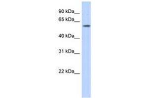Image no. 1 for anti-PiggyBac Transposable Element Derived 3 (PGBD3) (AA 71-120) antibody (ABIN6742696)