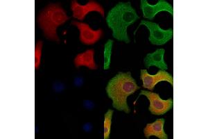 ABIN6263600 and ABIN6278494 staining Hela cells by IF/ICC.