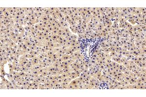 Detection of PRDX2 in Rat Liver Tissue using Polyclonal Antibody to Peroxiredoxin 2 (PRDX2) (Peroxiredoxin 2 antibody  (AA 6-164))