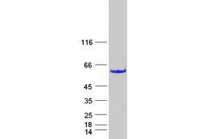 Coiled-Coil Domain Containing 97 (CCDC97) protein (Myc-DYKDDDDK Tag)