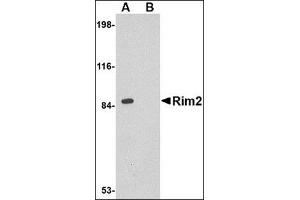 Western blot analysis of Rim2 in rat brain tissue lysate with this product at 1 μg/ml in the (A) absence or (B) presence of blocking peptide.