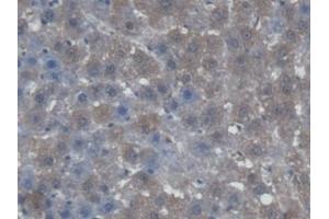 Detection of AGXT in Rat Liver Tissue using Polyclonal Antibody to Alanine Glyoxylate Aminotransferase (AGXT) (AGXT antibody  (AA 182-371))
