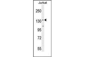 Western blot analysis of PPP1R3A Antibody  in Jurkat cell line lysates (35ug/lane). (PPP1R3A antibody  (Middle Region))