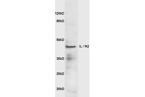 Mouse lung lysates probed with Anti-IL-1R2 Polyclonal Antibody  at 1:5000 90min in 37˚C.