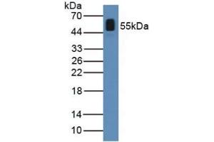 Detection of ANGPTL2 in Human Serum using Polyclonal Antibody to Angiopoietin Like Protein 2 (ANGPTL2) (ANGPTL2 antibody  (AA 267-493))
