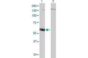 Western Blot analysis of P2RX5 expression in transfected 293T cell line by P2RX5 monoclonal antibody (M01), clone 1C5.