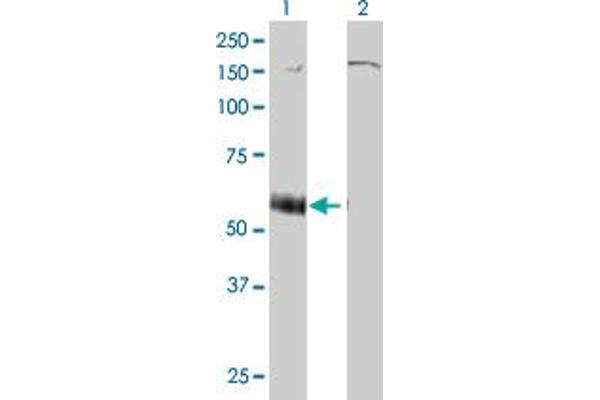 P2RX5 Antikörper  (AA 126-224)