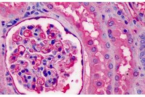 Human Kidney: Formalin-Fixed, Paraffin-Embedded (FFPE) (APOA1 antibody)