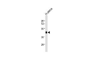 Anti-WNT7A Antibody at 1:2000 dilution + human uterus lysates Lysates/proteins at 20 μg per lane. (WNT7A antibody)