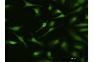 Immunofluorescence of purified MaxPab antibody to MAPKAPK3 on HeLa cell.