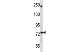 GCLC antibody western blot analysis in mouse bladder tissue lysate (GCLC antibody  (AA 286-315))