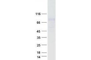 Validation with Western Blot (FCRL2 Protein (Transcript Variant 2) (Myc-DYKDDDDK Tag))