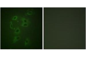 Immunofluorescence analysis of HepG2 cells, using CBL (Phospho-Tyr700) Antibody. (CBL antibody  (pTyr700))
