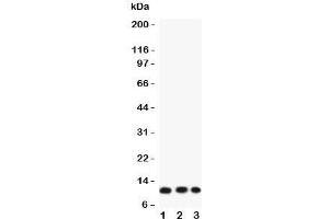 Western blot testing of Eotaxin 3 antibody and Lane 1:  COLO320;  2: A549;  3: HT1080 lysate. (CCL26 antibody  (AA 24-94))