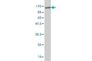 Western Blot detection against Immunogen (93. (NR1D1 antibody  (AA 1-614))